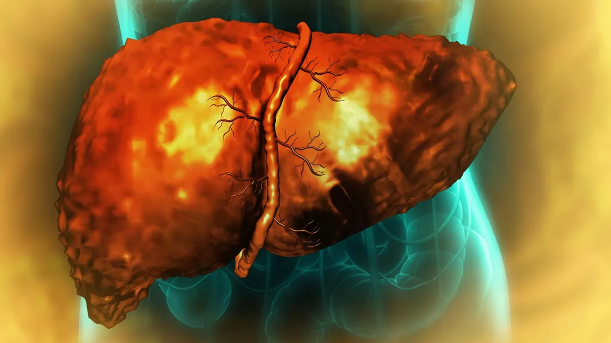 Wararka: Common dry-cleaning chemical linked to triple the risk of …